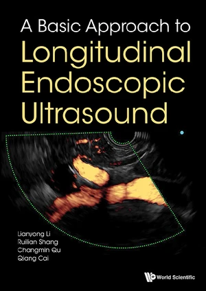 Basic Approach To Longitudinal Endoscopic Ultrasound, A