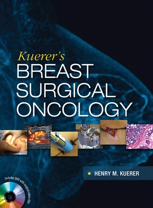 Kuerer's Breast Surgical Oncology