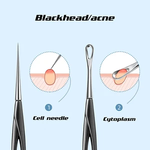 Blackhead Remover Cell Pimples Blackhead Clip Tweezers Removal Needle Beauty Salon Special Scraping Closing Acne Needle Tools