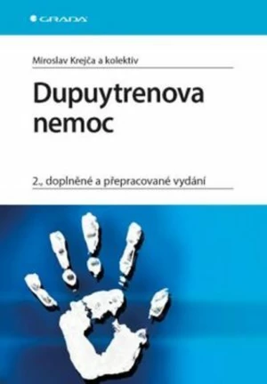 Dupuytrenova nemoc - Miroslav Krejča - e-kniha