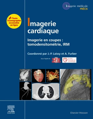 Imagerie cardiaque