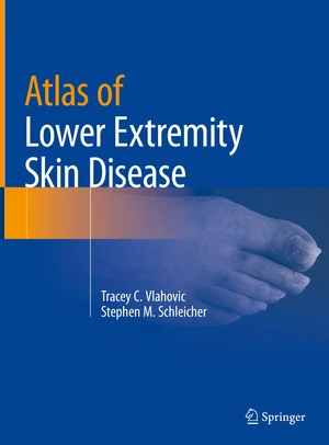 Atlas of Lower Extremity Skin Disease