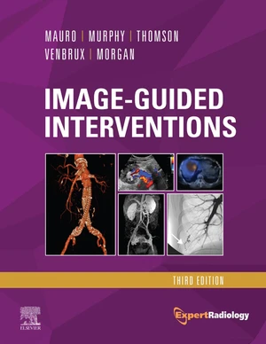 Image-Guided Interventions E-Book