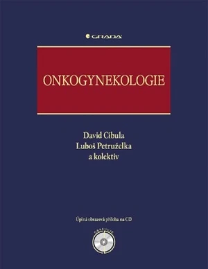 Onkogynekologie - David Cibula, Luboš Petruželka - e-kniha