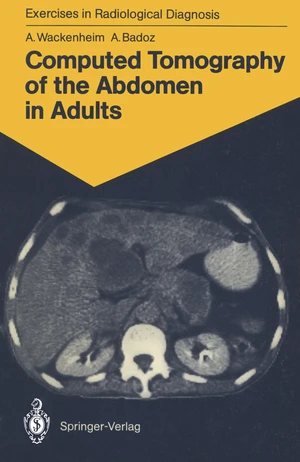 Computed Tomography of the Abdomen in Adults