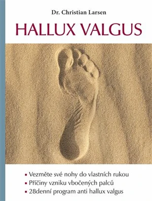 Hallux valgus - Christian Larsen
