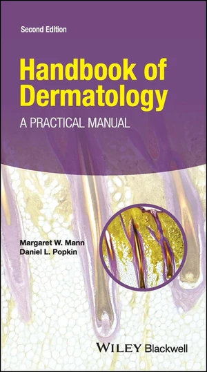 Handbook of Dermatology