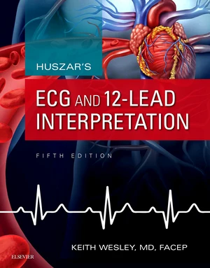 Huszar's ECG and 12-Lead Interpretation