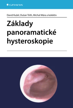 Základy panoramatické hysteroskopie - David Kužel, Tóth Dušan, Michal Mára - e-kniha