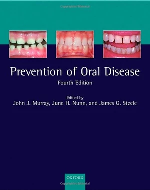 The Prevention of Oral Disease