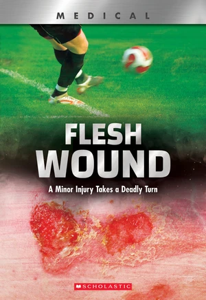 Flesh Wound (XBooks)