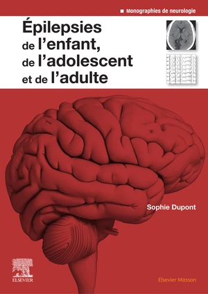 Epilepsies de l'enfant, de l'adolescent et de l'adulte