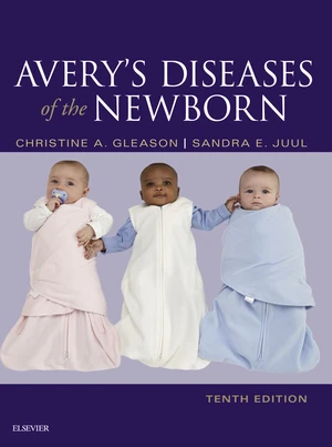 Avery's Diseases of the Newborn E-Book