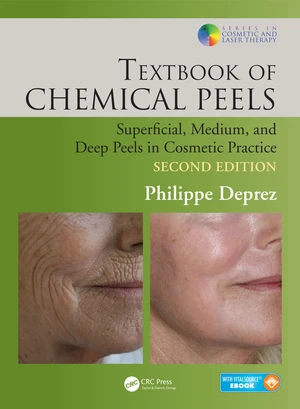 Textbook of Chemical Peels