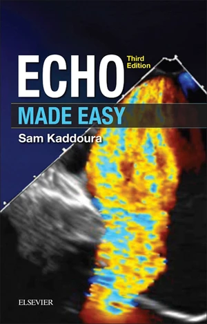 Echo Made Easy E-Book