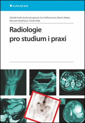 Radiologie pro studium i praxi - Zdeněk Seidl, Manuela Vaněčková, Andrea Burgetová, Eva Hoffmannová, Martin Mašek, Tomáš Viták