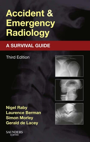 Accident and Emergency Radiology