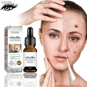 Wart Mole Removal Painless Fast Remover Serum Wart Tag Serum Skin Removal Mole Fast Remover Skin Care