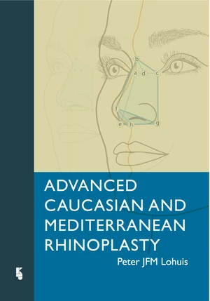 Advanced Caucasian and Mediterranean Rhinoplasty