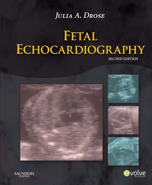 Fetal Echocardiography - E-Book