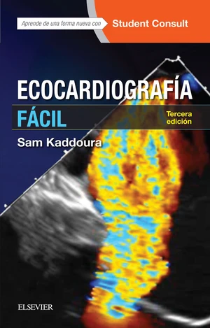 EcocardiografÃ­a fÃ¡cil