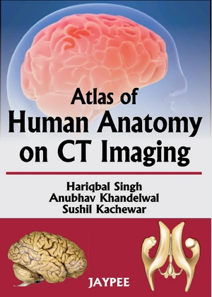 Atlas Of Human Anatomy On CT Imaging