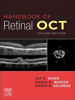 Handbook of Retinal OCT