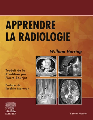 Apprendre la radiologie