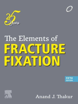 The Elements of Fracture Fixation - E-Book