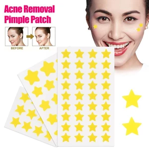 Star Pimple Patch Acne Colorful Invisible Acne Removal Stickers Face NEW Skin Originality Care Makeup Y2K Spot Concealer Be B3G5
