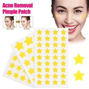 Star Pimple Patch Acne Colorful Invisible Acne Removal Skin Care Stickers Originality Concealer Face Spot Beauty Makeup Tool