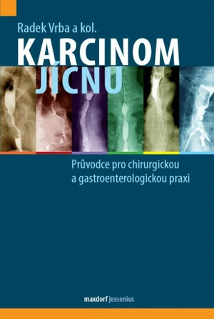 Karcinom jícnu - Vrba Radek