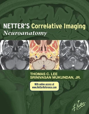 Netterâs Correlative Imaging