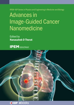 Advances in Image-Guided Cancer Nanomedicine