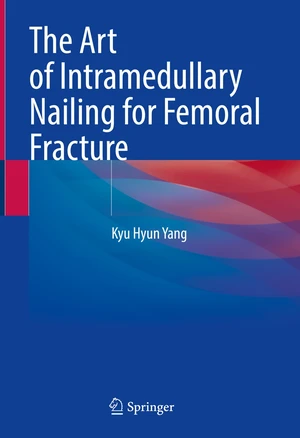 The Art of Intramedullary Nailing for Femoral Fracture