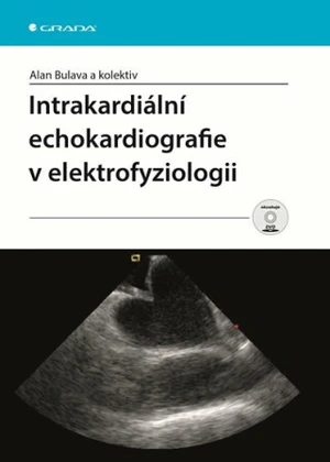 Intrakardiální echokardiografie v elektrofyziologii - Alan Bulava
