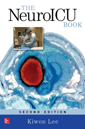 The NeuroICU Book, Second Edition