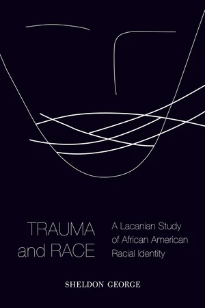 Trauma and Race