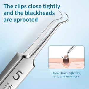German Ultra-fine No. 5 Cell Pimples Blackhead Clip Tweezers Beauty Salon Special Scraping & Closing Artifact Acne Needle Tools