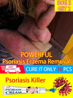 Psoriasis Cream Ointment For Psoriasis Skin Eczema Best Against Psoriasis Treatment Products