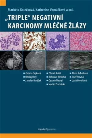 "Triple" negativní karcinomy mléčné žlázy - Markéta Kolečková, Katherine Vomáčková