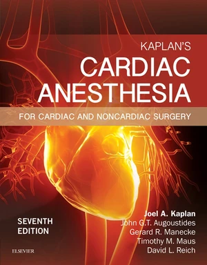 Kaplan's Cardiac Anesthesia E-Book