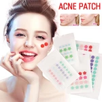 Acne Patch Waterproof Acne Pimple Treatment Stickers Freckle Care Scare Facial Skin Blackhead Spot Concealer Face Removal M X9C0