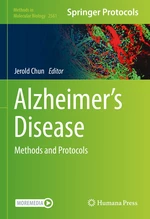 Alzheimerâs Disease