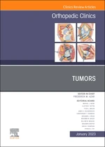 Tumors, An Issue of Orthopedic Clinics, E-Book