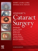 Cataract Surgery