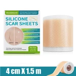 Self-adhesive Silicone Scar Sheets Scar Repair Patch Stretch Mark Tape Effective Scar Removal Patch for Burn Acne Scar Skin Care