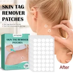 120pcs Skin Tag Remover Patch Wart Treatment Stickers Absorb Plaster Hydrocolloid Invisible Acne Patch Skin Care Stickers