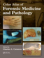 Color Atlas of Forensic Medicine and Pathology