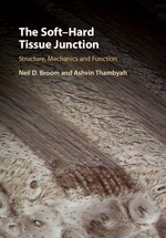 The SoftâHard Tissue Junction